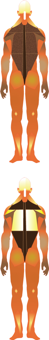 Infusing the upper back