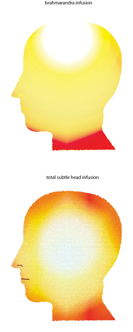 Head infusion