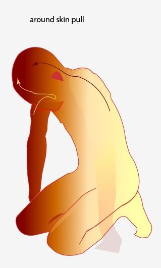 skin-around lift