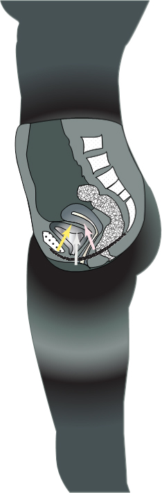 Sex Lock Details  