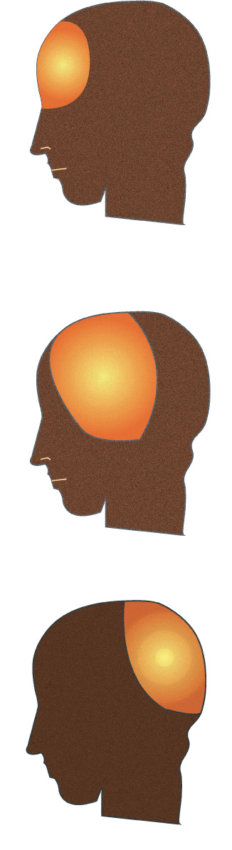 Breath infusion in the head