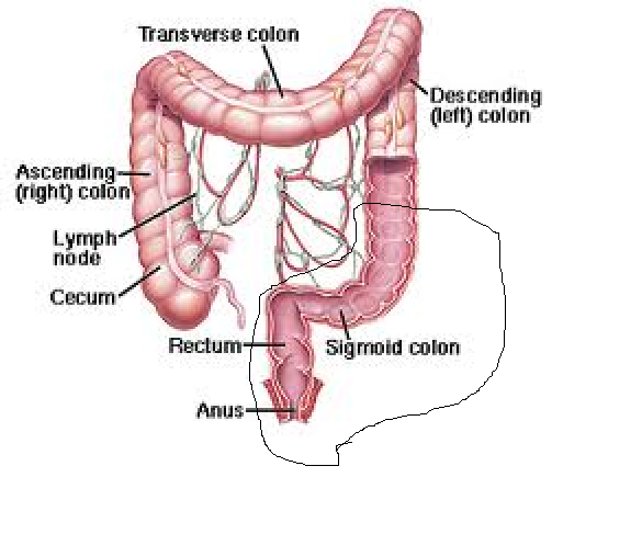 Anesthesia immobilizes the rectum and the sigmoid colon